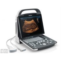 Mindray DP-10 Ecografo Portatile con Doppler Pulsato e iClear