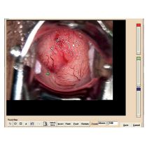 Software Colposcopia Colpro AC-2311 per Ginecologia Multilingue