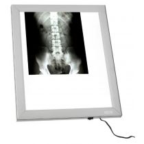 Negativoscopio verticale X-ray a LED - 42X49 Cm